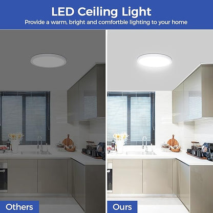 Flush Mount Ceiling Light Fixtures,24W Flat led Light for Ceiling,6000K 2200LM Ultra Thin Round White Lamp for Bedroom Kitchen,Bathroom,Garage,Living Room, Dining Room -2PCS